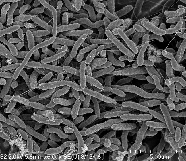 Methylmercury EM