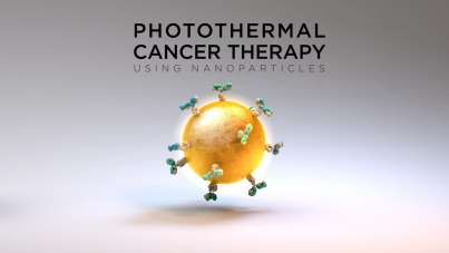 Photothermal Cancer Therapy